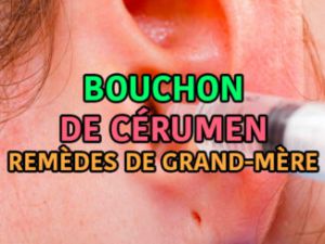 Recette Mauvaise haleine : bicarbonate, quand ça peut aider