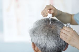 Recette Procapil vs. Minoxidil: Which Is Better for Hair Loss?