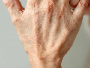 Recette Ce que la peau des mains dit de votre état de santé