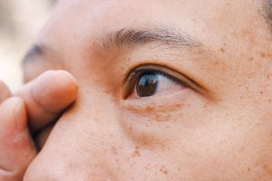 Recette 9 Common Causes of Blurry Vision in One Eye You Should Know