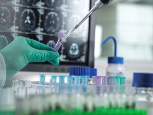 Recette How Is Huntington's Disease Diagnosed?